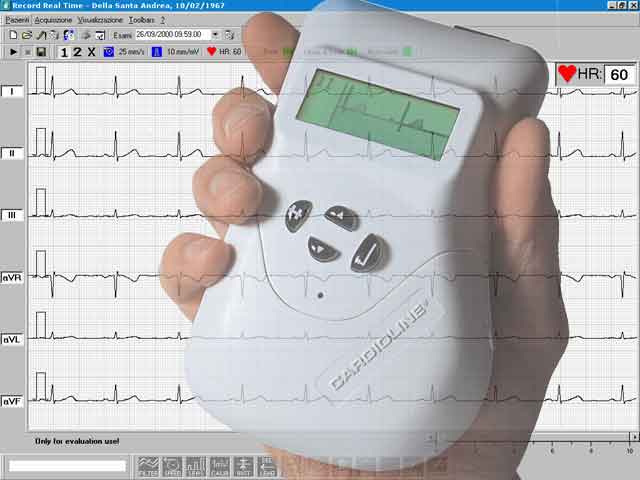 ECG PRIMA