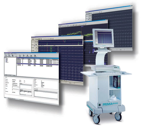 ECG STRESS TEST